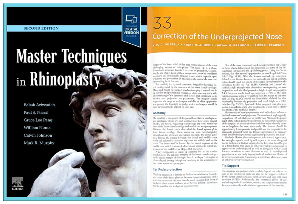 Pearson Rhinoplasty Publication