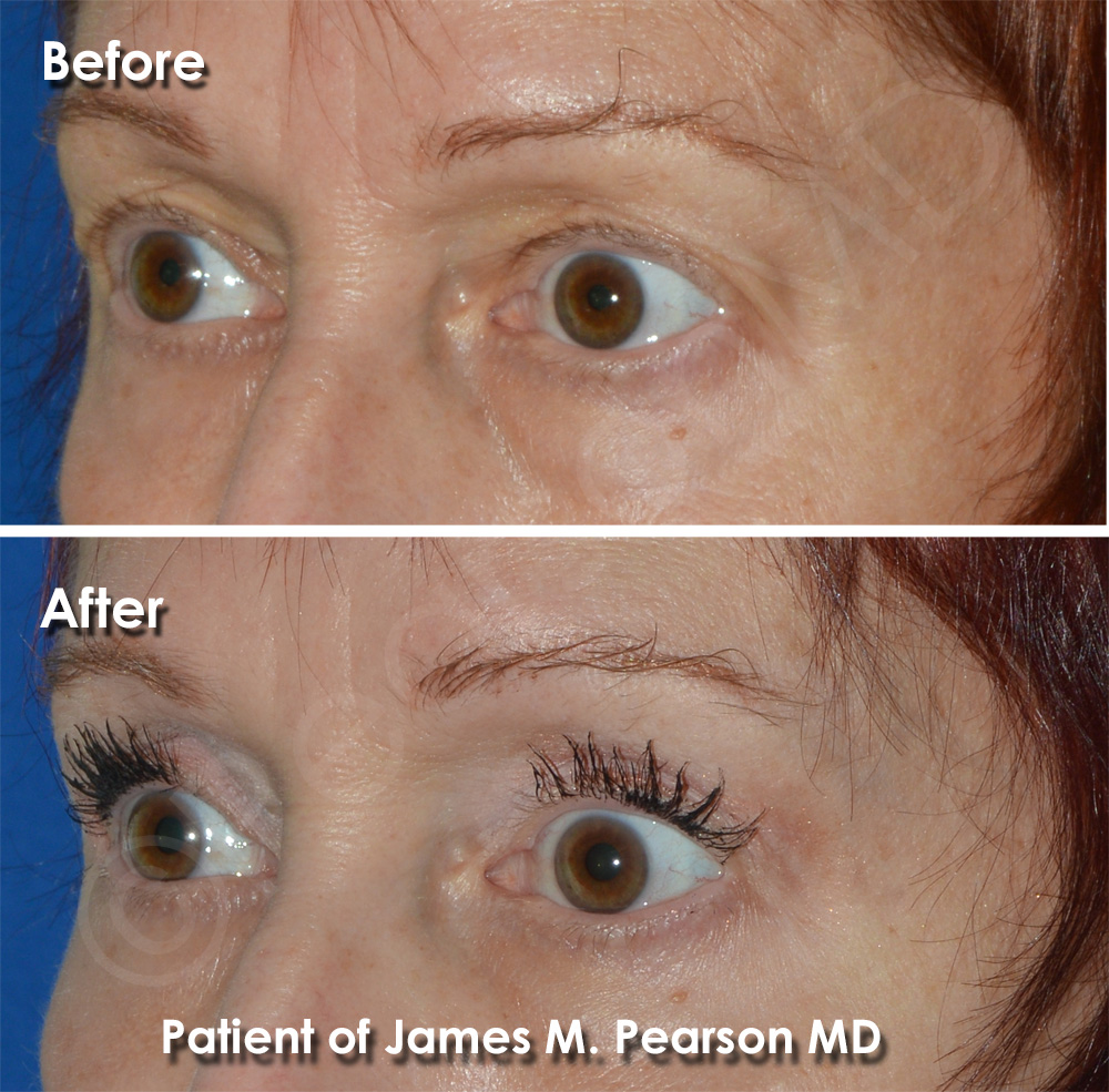 Pearson Plastic Surgery Photo
