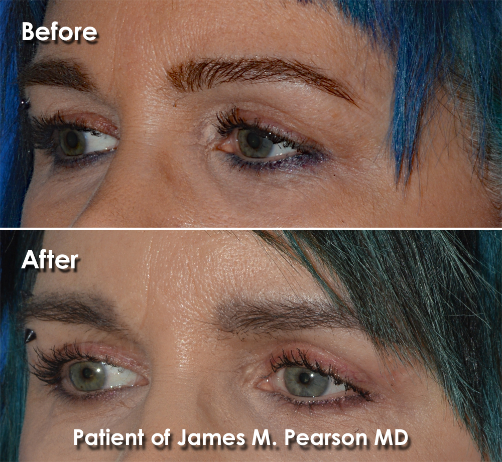 Pearson Plastic Surgery Photo