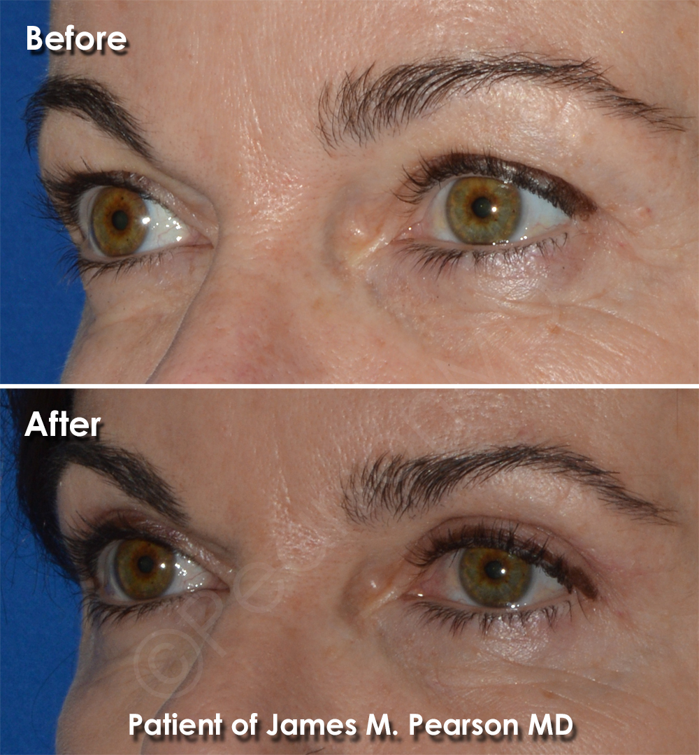 Pearson Cosmsetic Surgery Photo