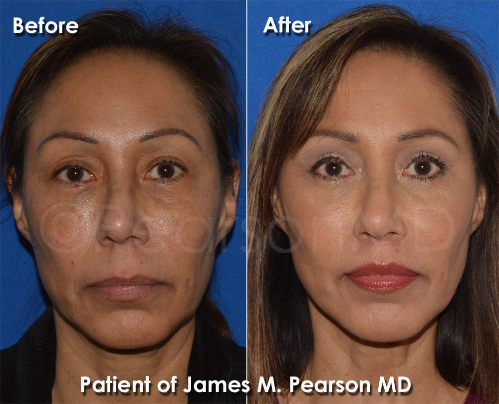 Pearson Cosmetic Surgery Photo