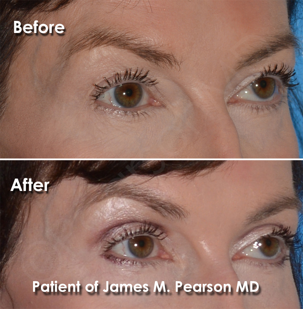 Pearson Plastic Surgery