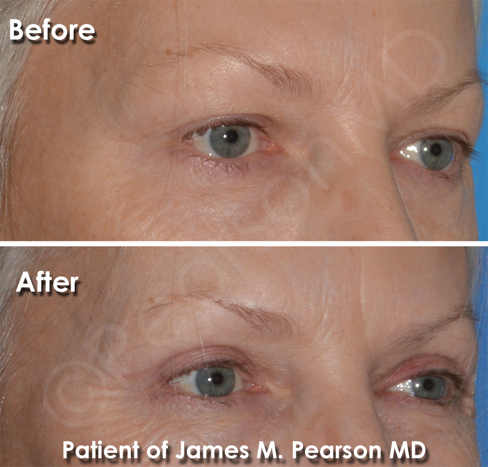Pearson Plastic Surgery