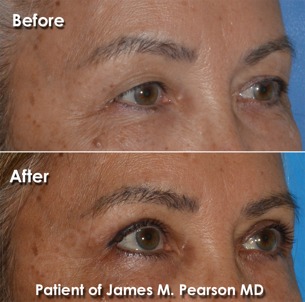 Pearson Plastic Surgery