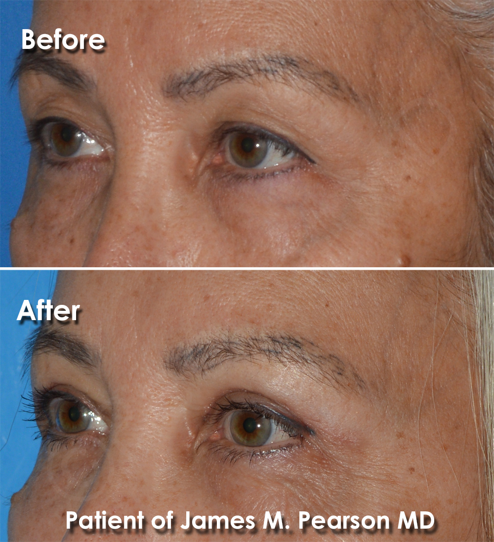 Pearson Plastic Surgery