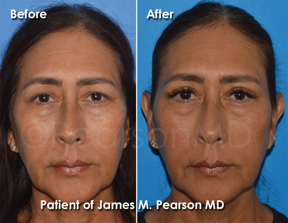 Pearson Plastic Surgery
