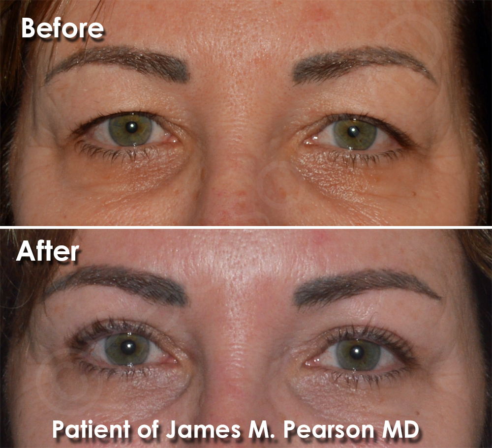 Pearson Plastic Surgery
