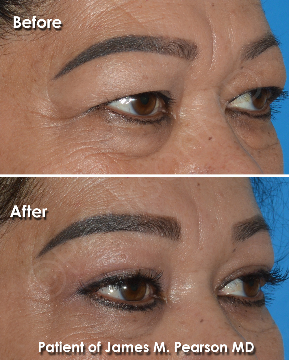Pearson Plastic Surgery