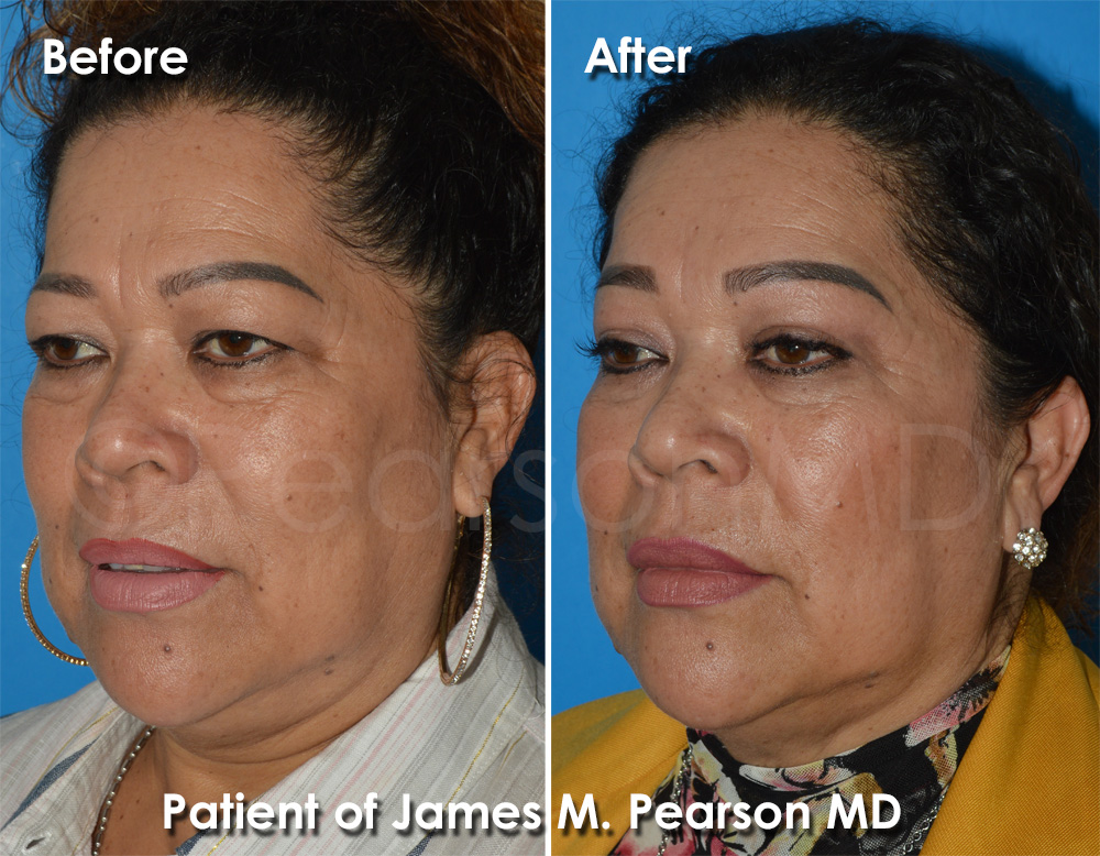 Pearson Cosmetic Surgery