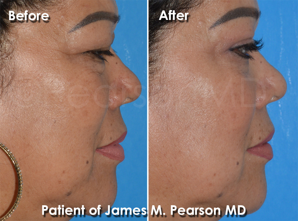 Dr. Pearson Plastic Surgery