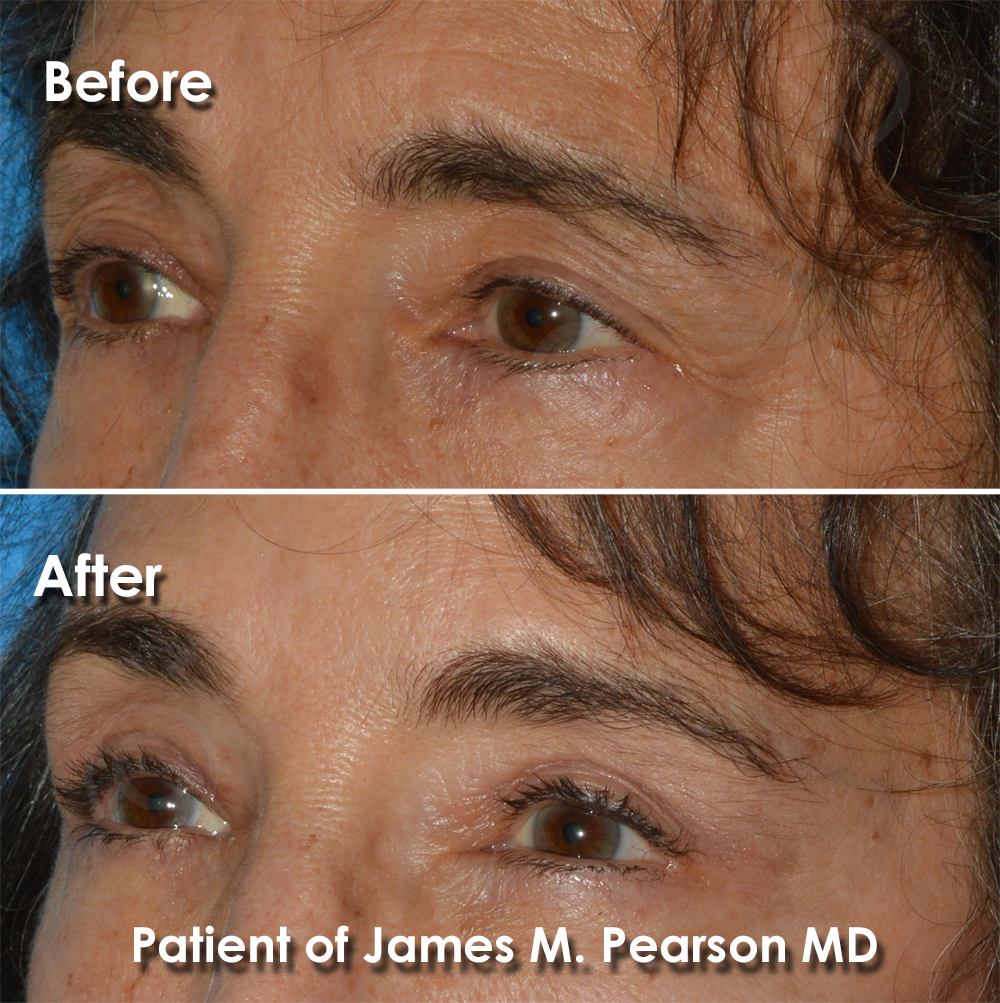 Pearson Plastic Surgery
