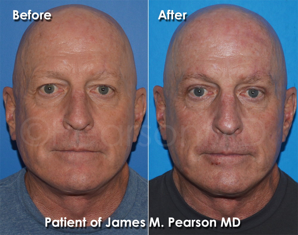 Pearson Plastic Surgery
