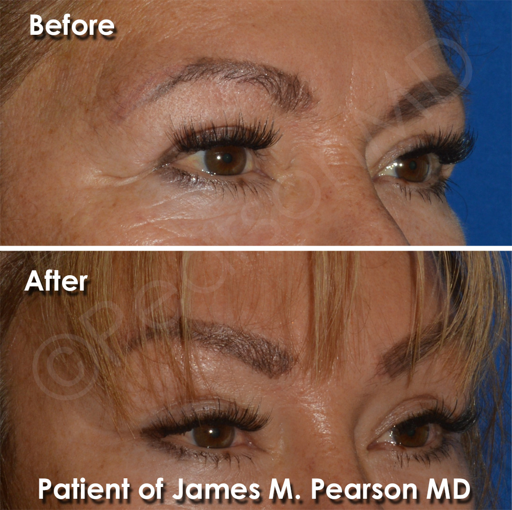 Pearson Plastic Surgery