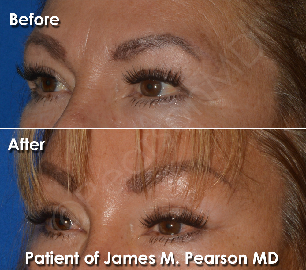 Pearson Plastic Surgery