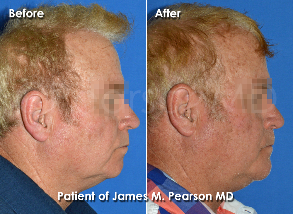 Pearson Plastic Surgery