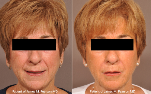 Photo Dr. Pearson cosmetic treatment