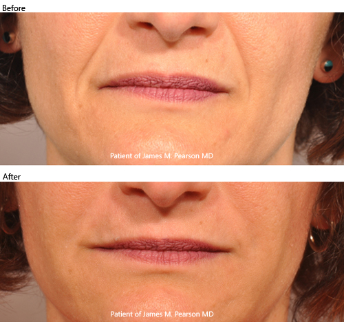 Photo Dr. Pearson cosmetic treatment