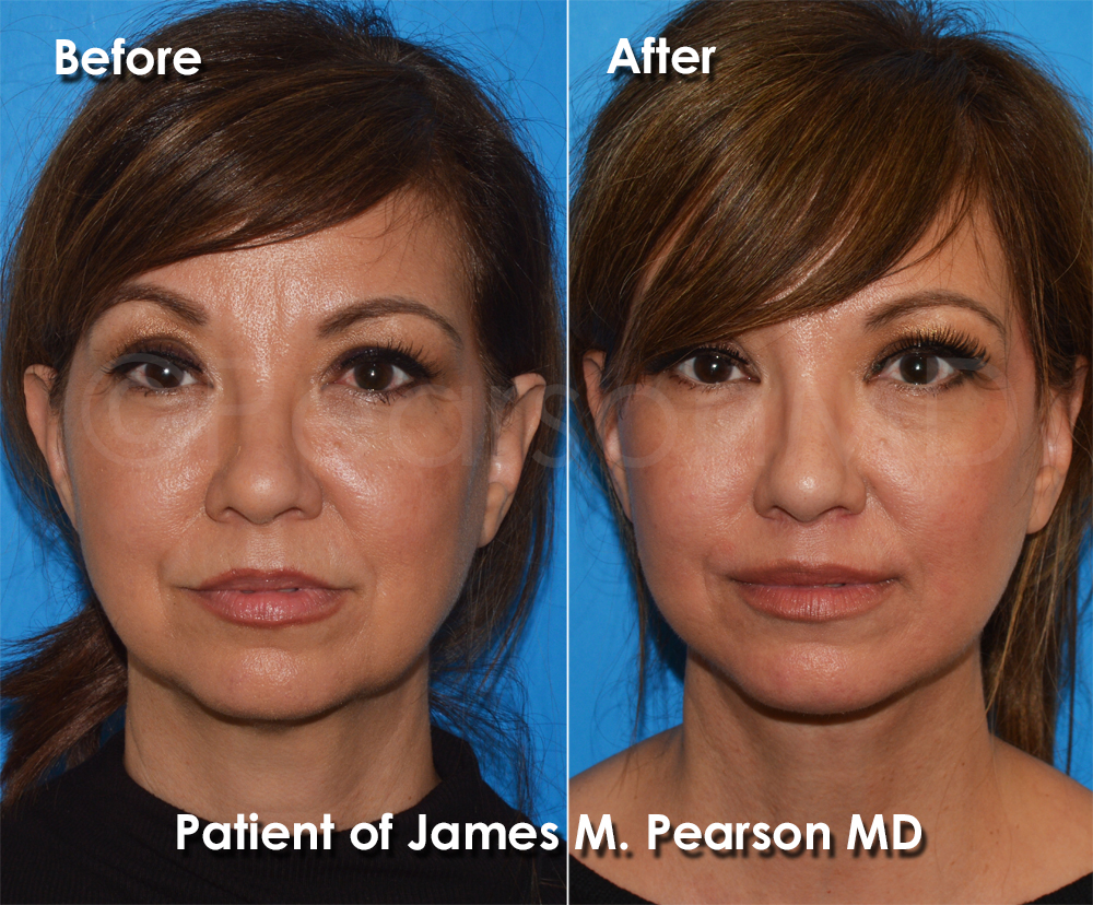 Pearson Plastic Surgery