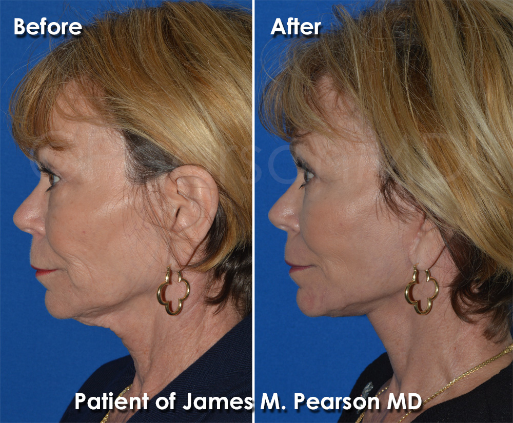 Pearson Cosmetic Surgery