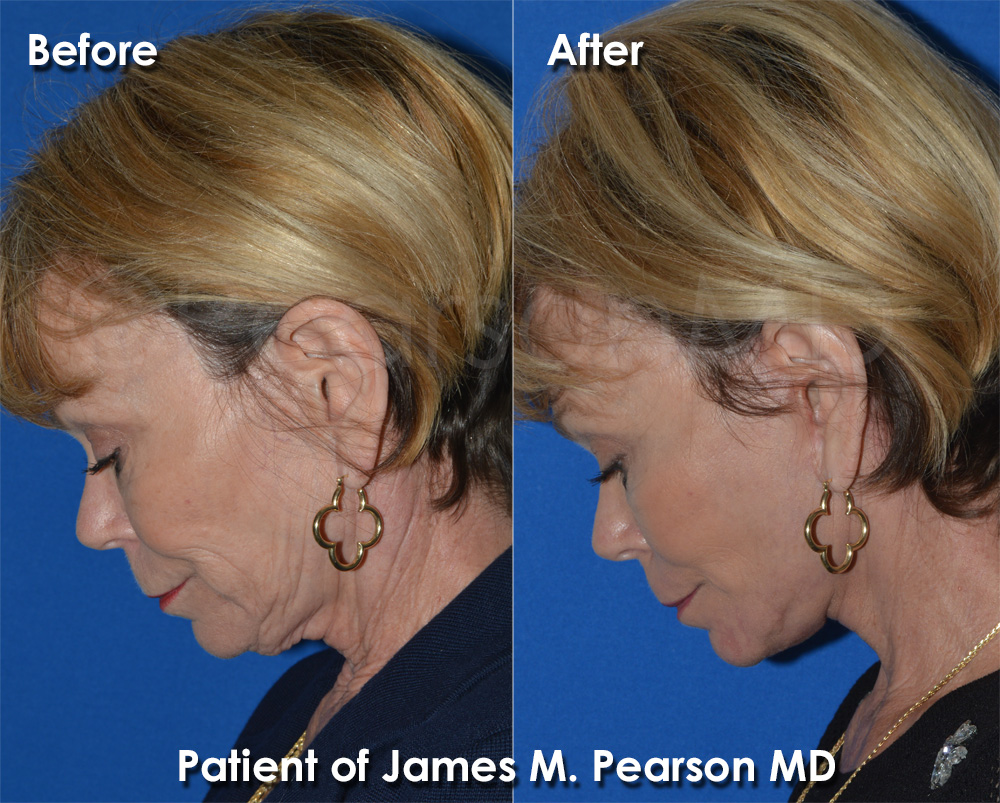 Pearson Cosmetic Surgery