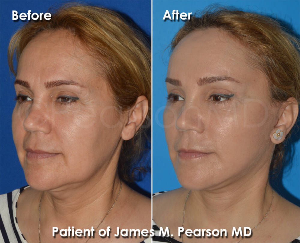 Pearson Cosmetic Surgery