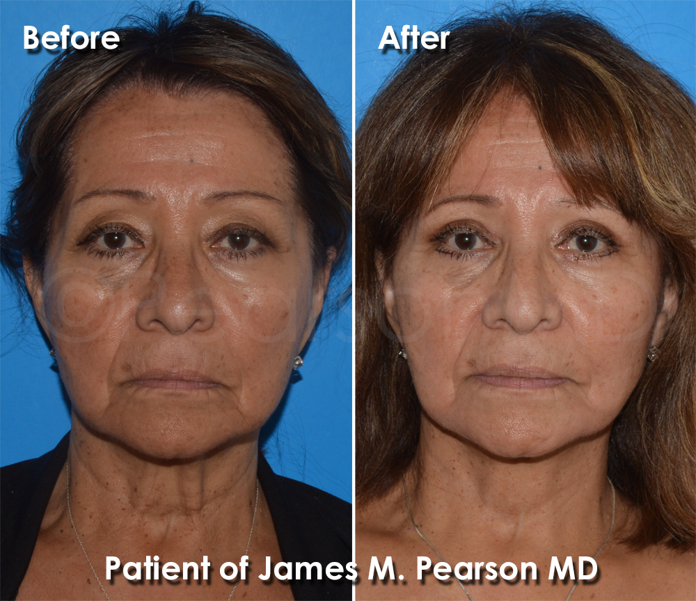 Pearson Plastic Surgery