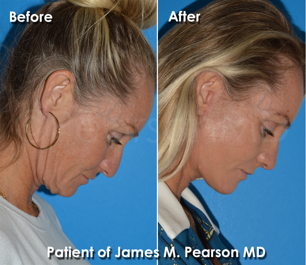 Pearson Cosmetic Surgery