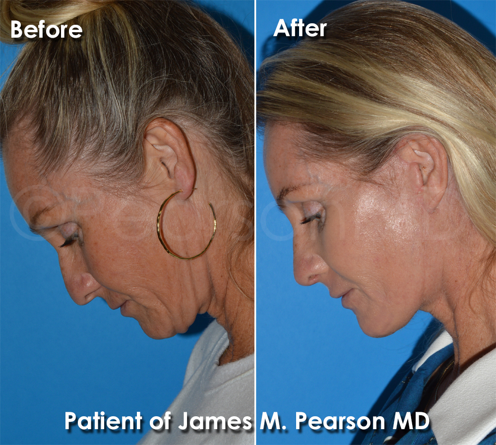 Dr. Pearson Plastic Surgery
