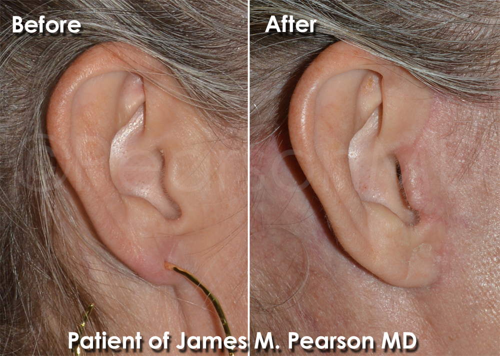 Pearson Plastic Surgery