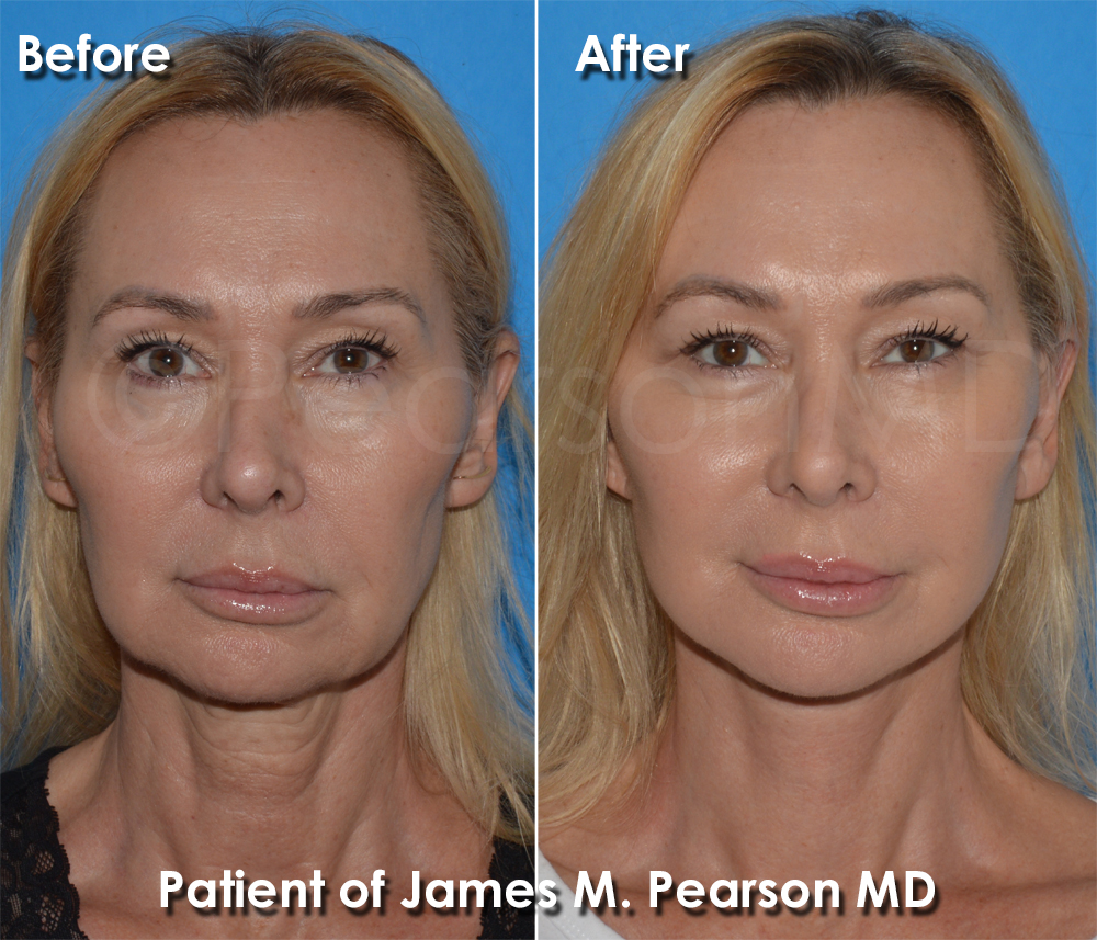 Pearson Cosmetic Surgery