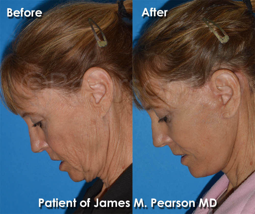 Dr. Pearson Plastic Surgery