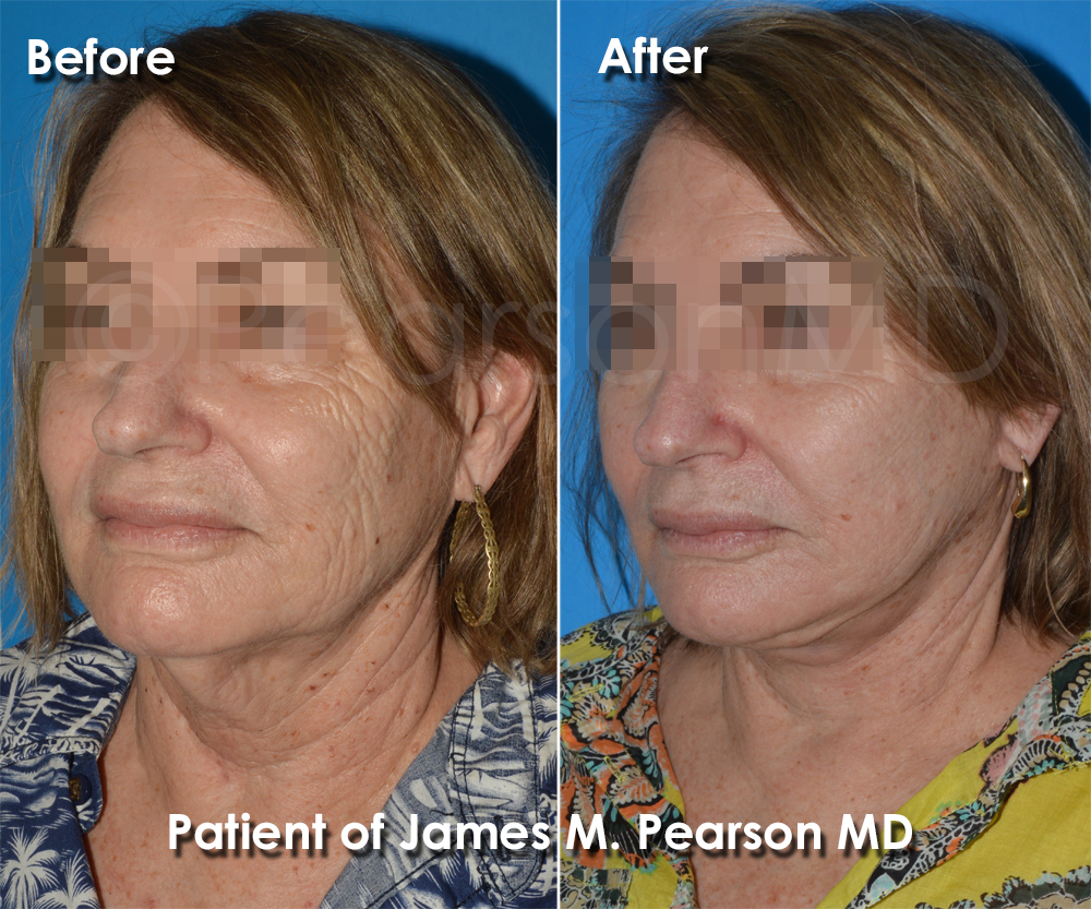 Pearson Cosmetic Surgery