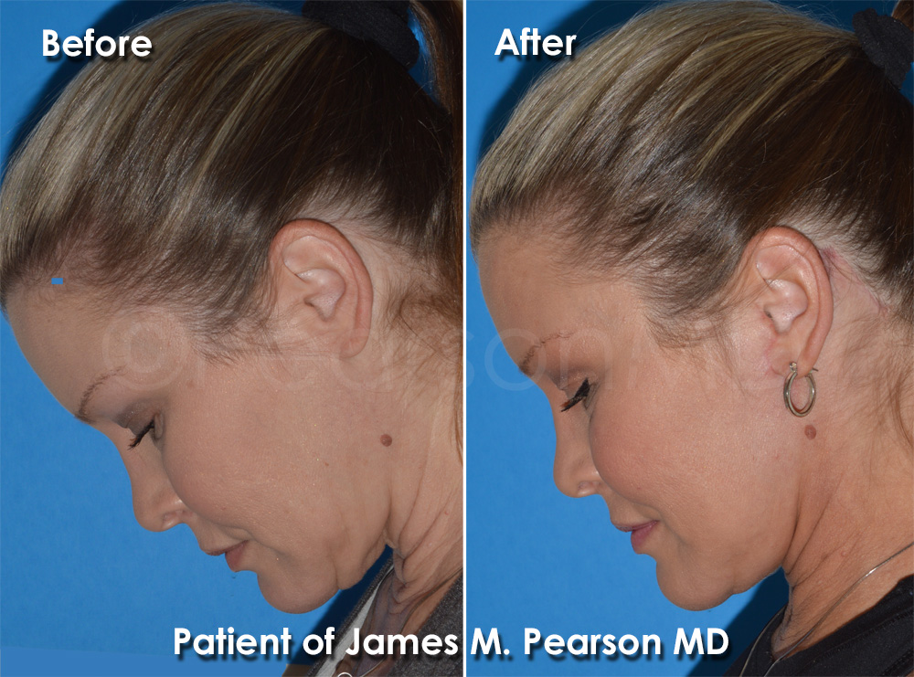 Dr. Pearson Plastic Surgery