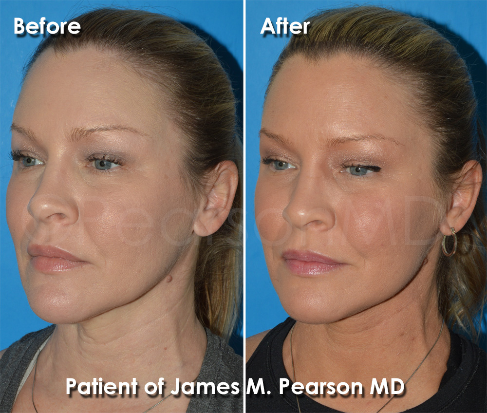 Pearson Cosmetic Surgery