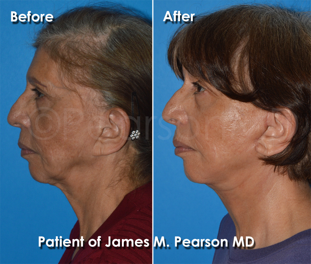Pearson Cosmetic Surgery