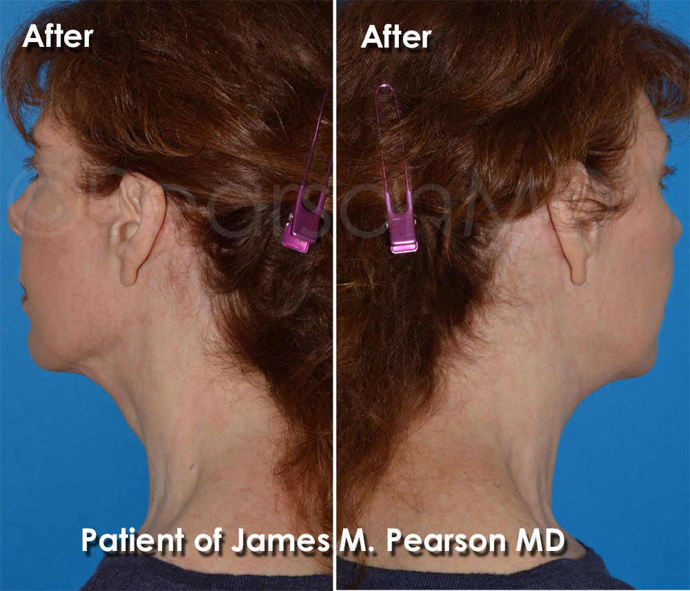 Pearson Cosmetic Surgery