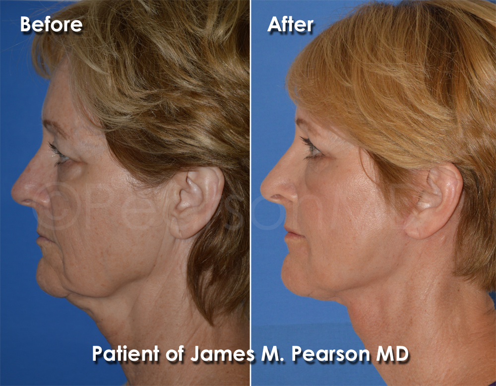 Pearson Cosmetic Surgery