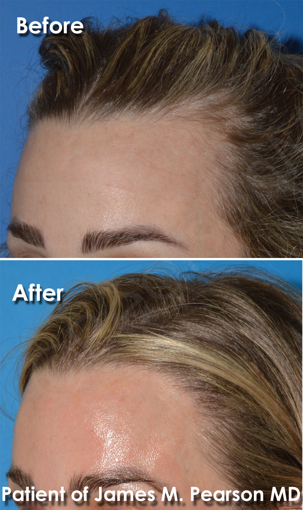Pearson Plastic Surgery