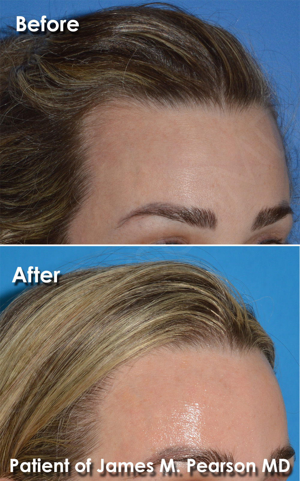 Dr. Pearson Facial Plastic Surgeon