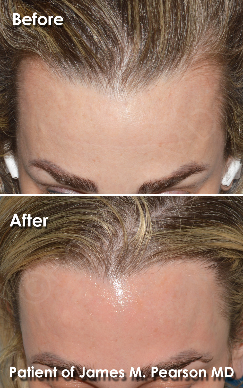 Dr. Pearson Plastic Surgeon
