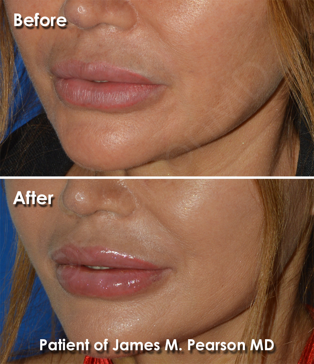 Dr. Pearson Plastic Surgery