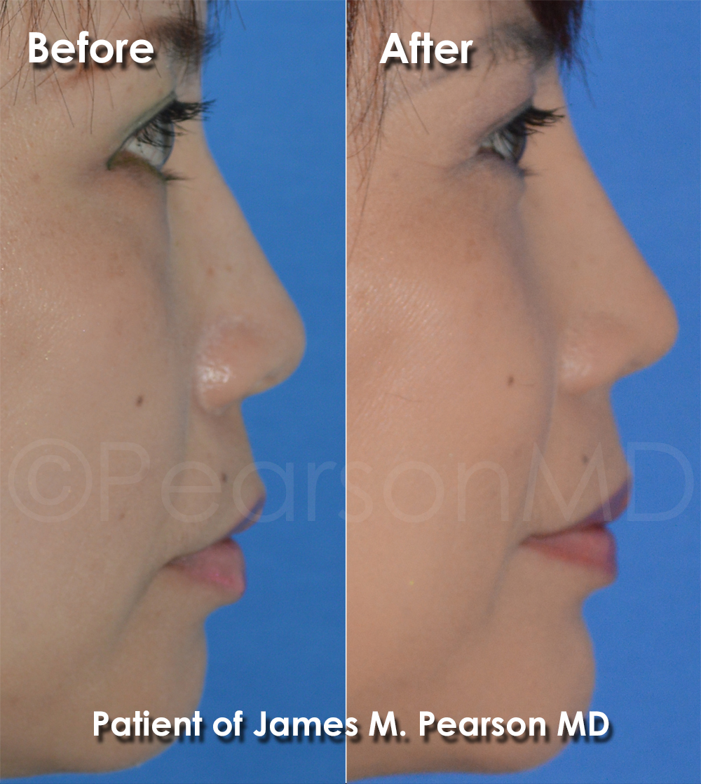 Pearson Plastic Surgery