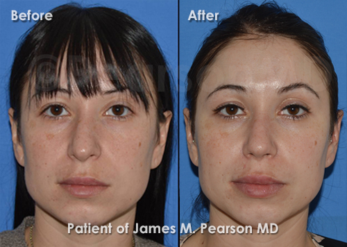 Pearson Plastic Surgery
