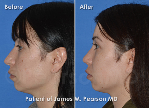 Pearson Plastic Surgery
