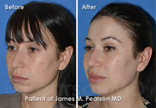Pearson Cosmetic Surgery