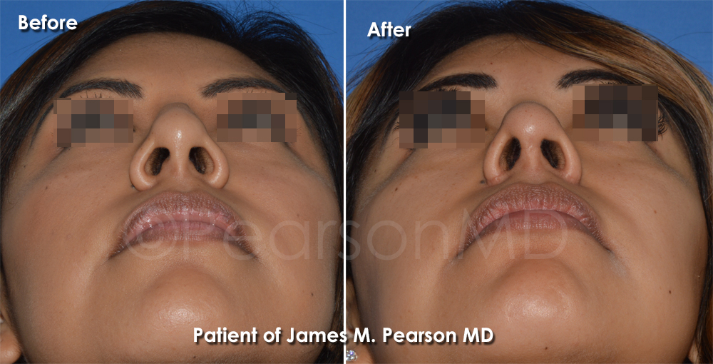 Pearson Plastic Surgery