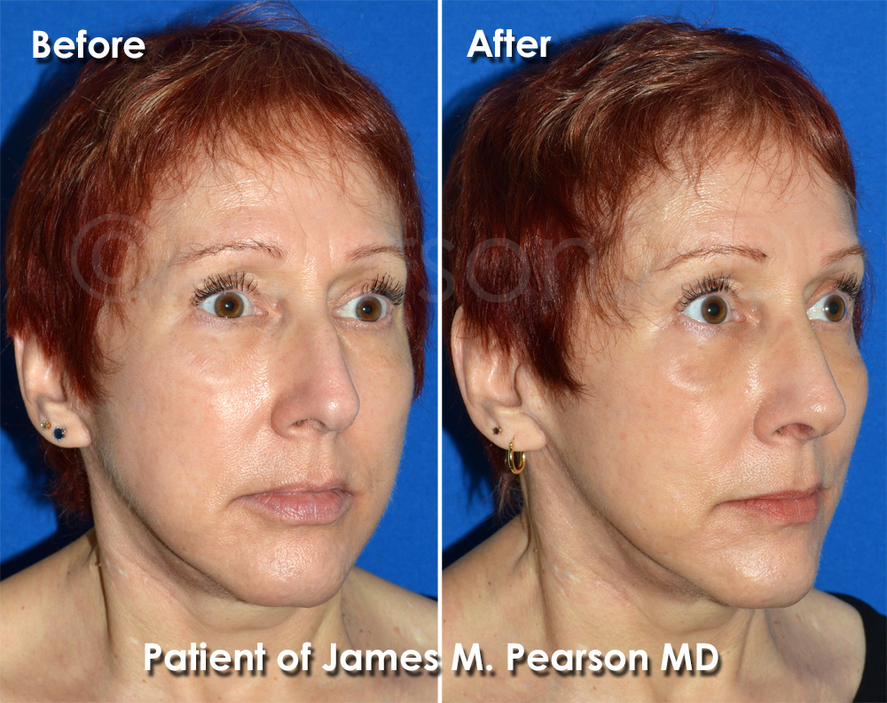 Pearson Cosmetic Surgery