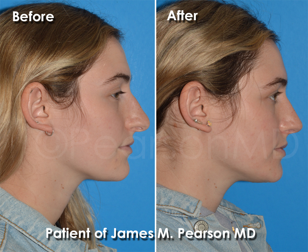 Pearson Plastic Surgery