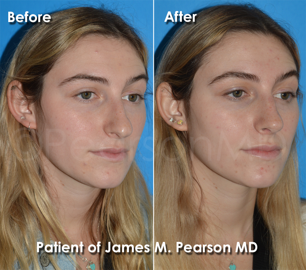 Pearson Cosmetic Surgery