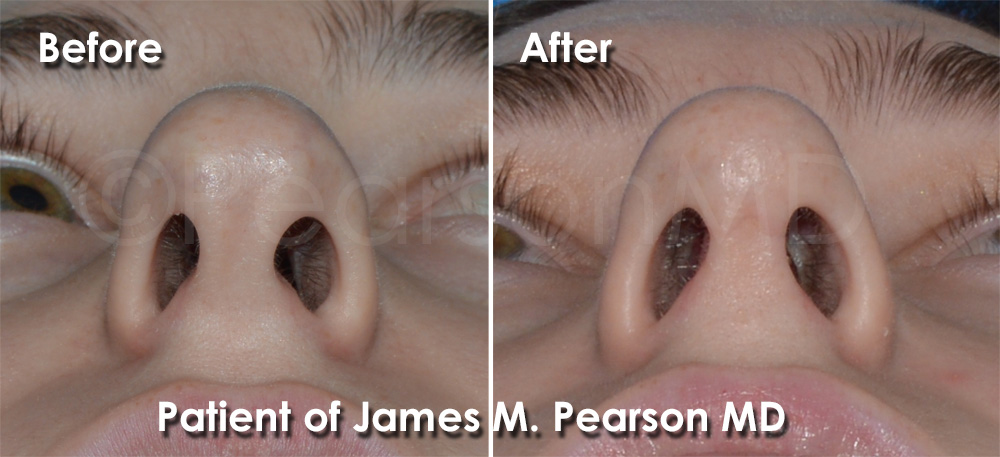 Pearson Plastic Surgery